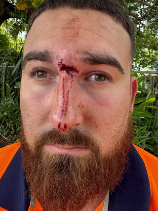 Safety Glasses saved eye from injury